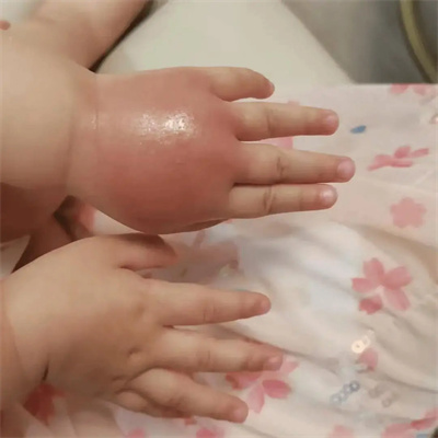 图片说明